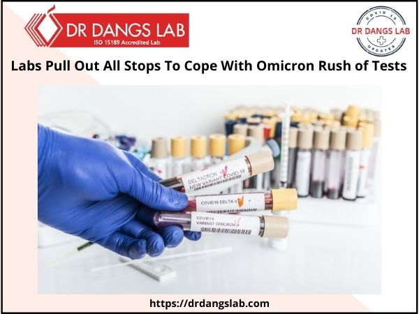 Omicron testing rush